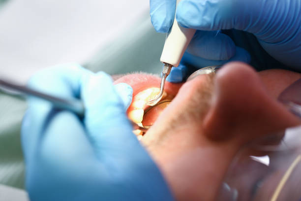 Best Broken Tooth Emergency  in Melrose Park, NY